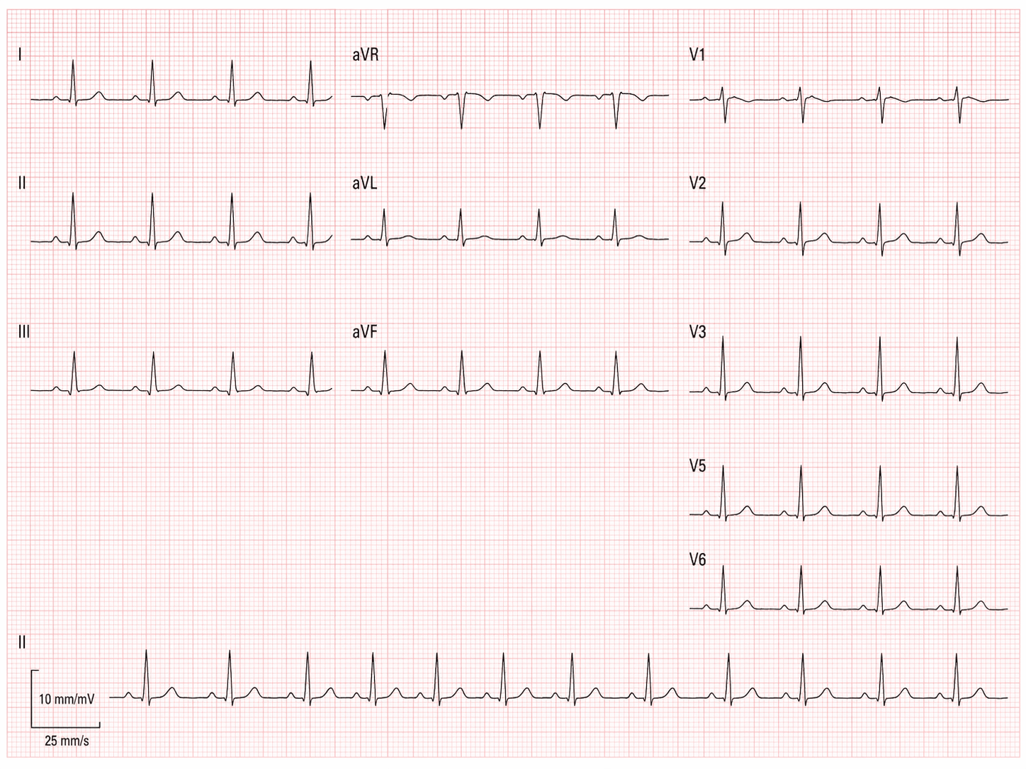 心電図検査イメージ
